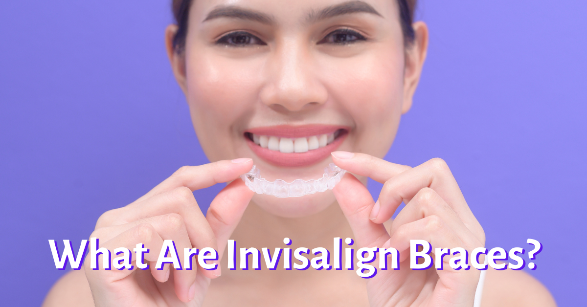 What Are Invisalign Braces? Dental Insurance Insiders