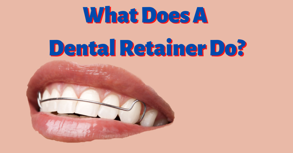 What Does A Dental Retainer Do? Dental Insurance Insiders