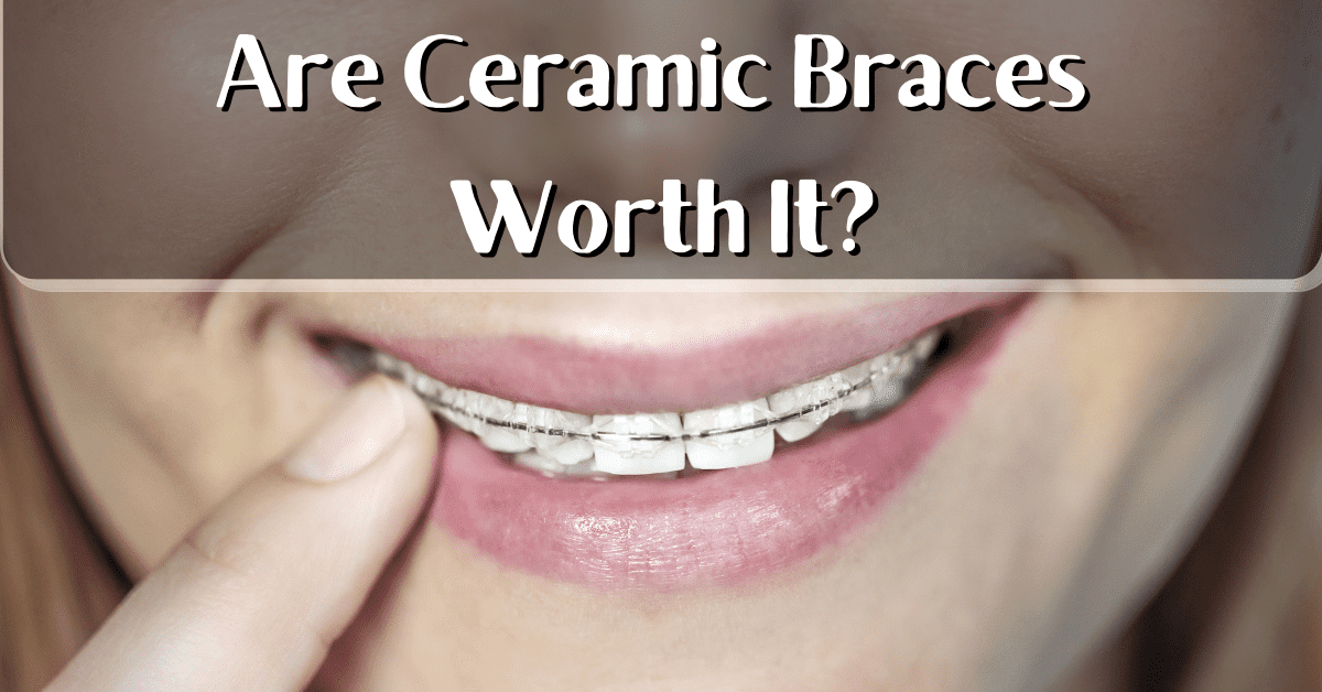Are Ceramic Braces Worth It? Dental Insurance Insiders