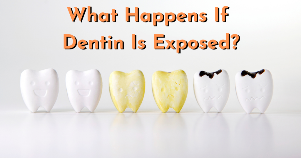 What Happens If Dentin Is Exposed? Dental Insurance Insiders